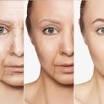 البوتكس