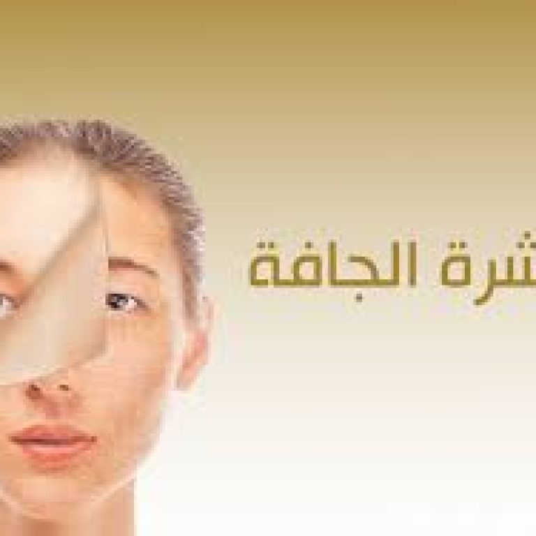 البشرة الجافة